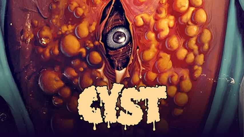 فيلم Cyst 2020 مترجم